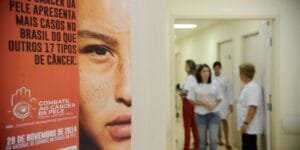 Aumento alarmante de Casos de câncer de pele no Brasil