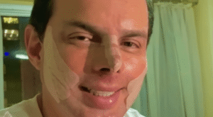 Esdras de Souza, marido de Gretchen, realiza procedimento estético e celebra resultados