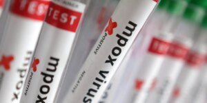 Casos Confirmados de Mpox no Brasil Atingem 140 em 2026