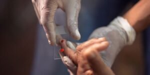 SUS Implementa Novo Tratamento Inovador para Malária em Crianças