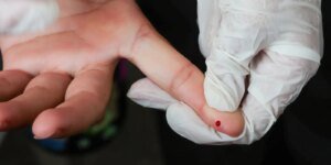 SUS Introduz Teste Rápido para Diagnóstico de Dengue