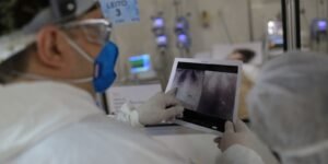 Broncopneumonia: Compreenda a Condição que Levou à Internação de Jair Bolsonaro